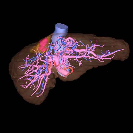 肝臓の3D（動脈、門脈、静脈と肝実質の体積解析）.jpg